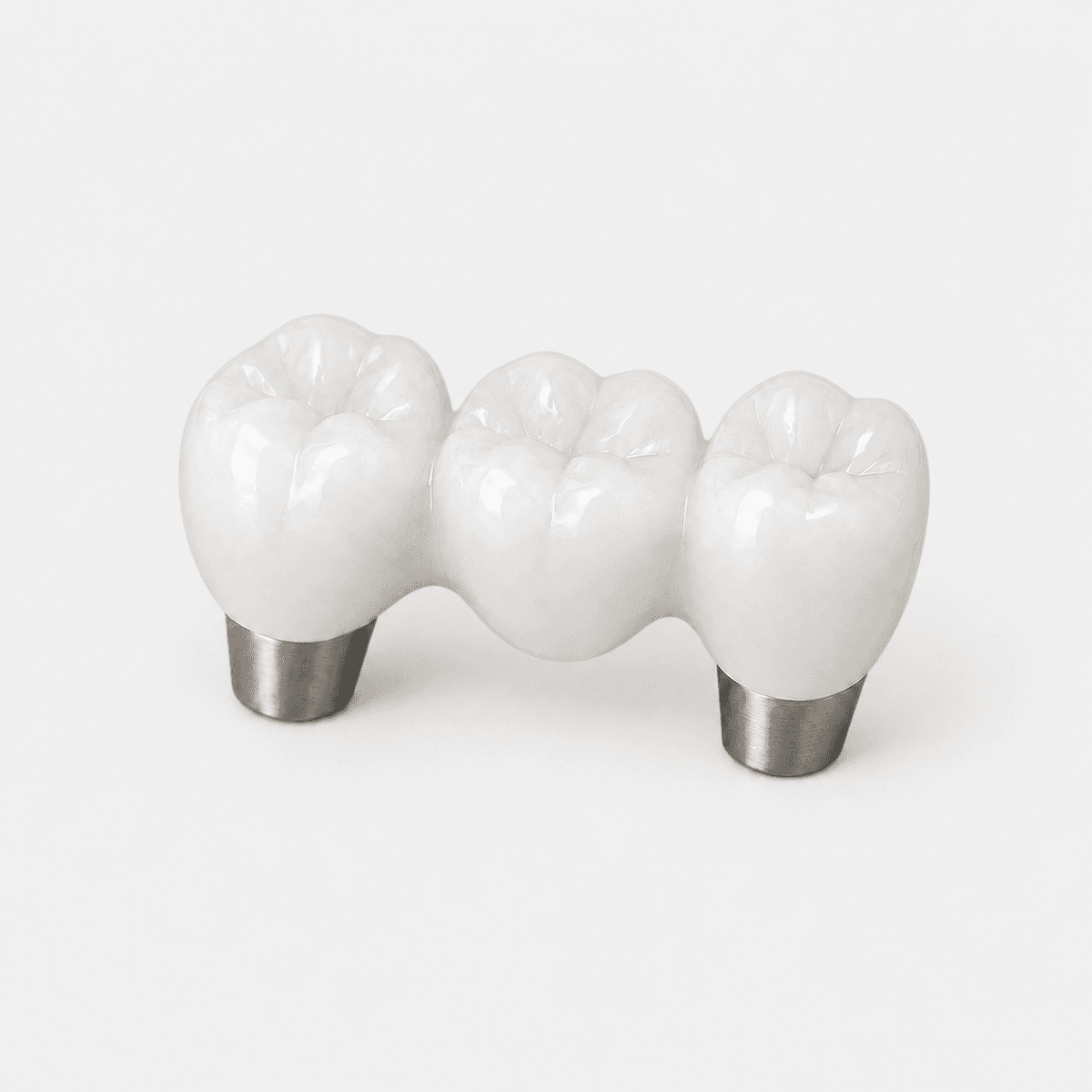 Implant Bridges