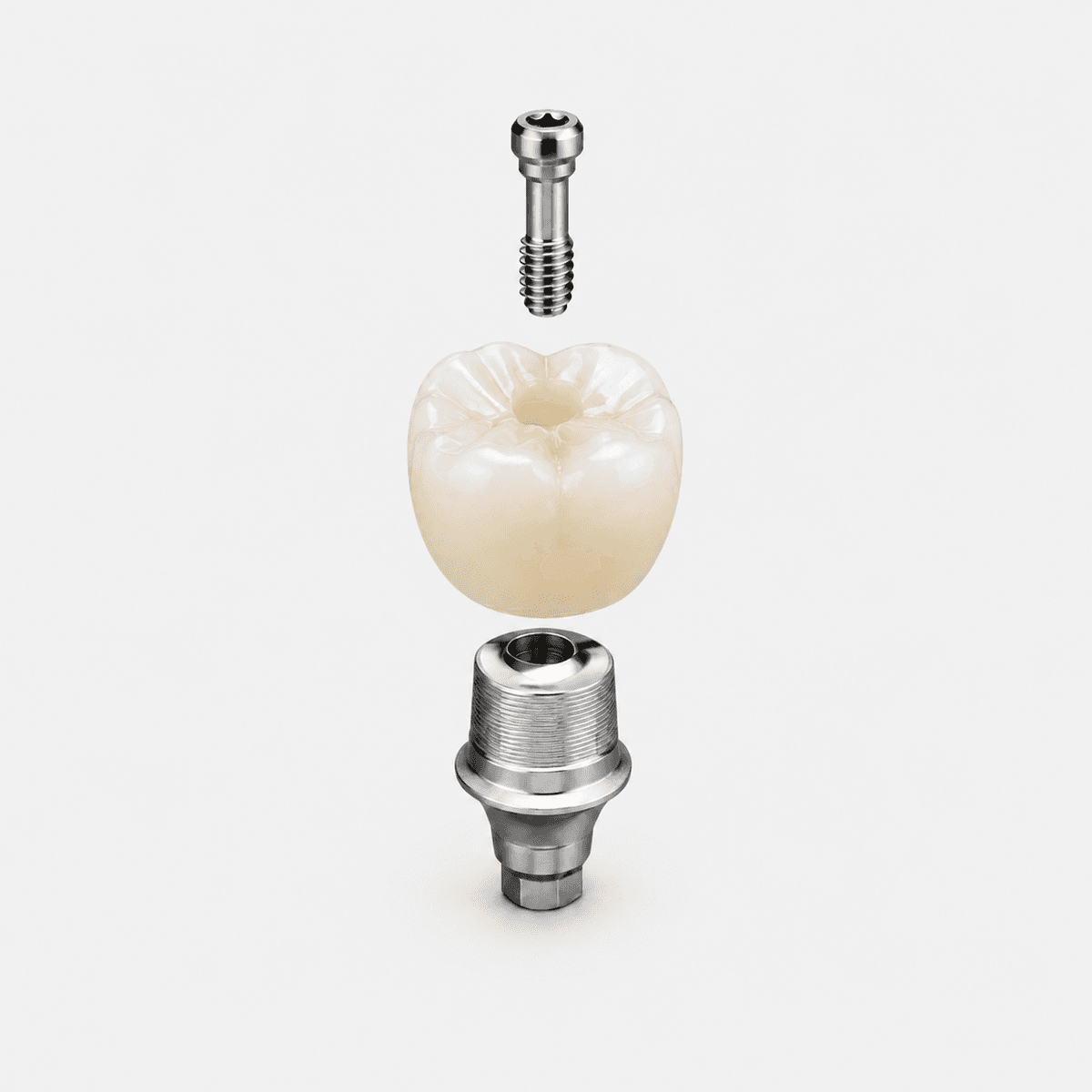 Screwmentable Crown & Abutment