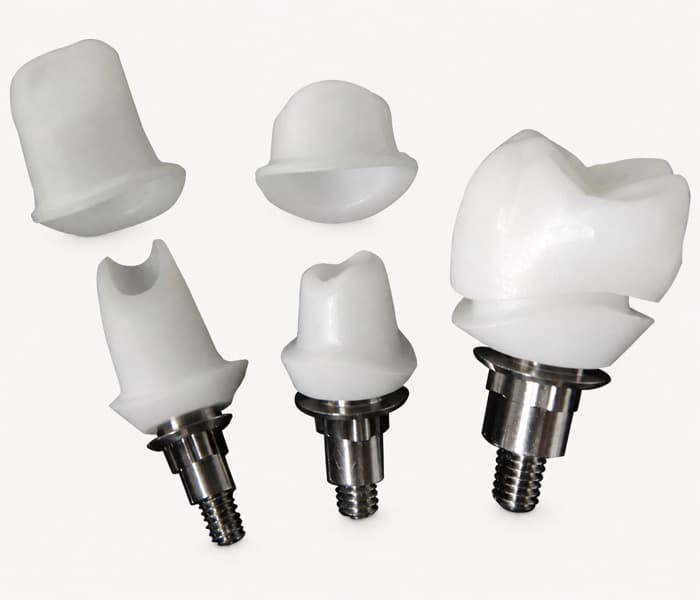 Zirconia Hybrid Custom Abutment